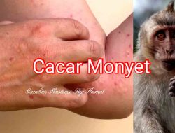 Catar Minyet 1