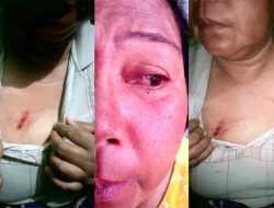 Kejadian Pengeroyokan Belum Ada Penyelesaian, Korban: Mungkin Karena Saya Tidak Ada Keluarga Polisi Ya?