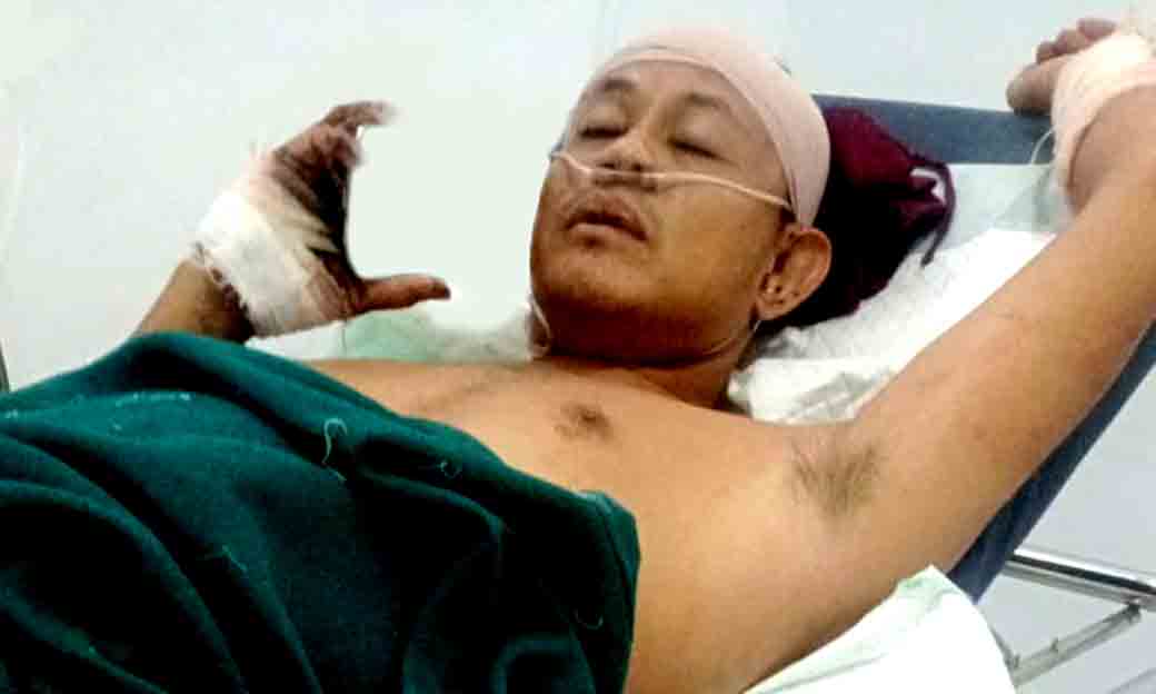 Preman Sadis Bacok Jurnalis Di Tuban