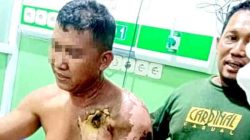 Pegawai Harian PTPN Takalar Tersengat Listrik: Diduga Akibat Lalainya Standar K3, Korban Kritis di RS Wahidin