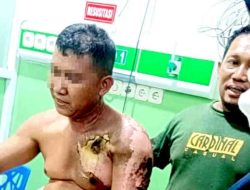Pegawai Harian PTPN Takalar Tersengat Listrik: Diduga Akibat Lalainya Standar K3, Korban Kritis di RS Wahidin