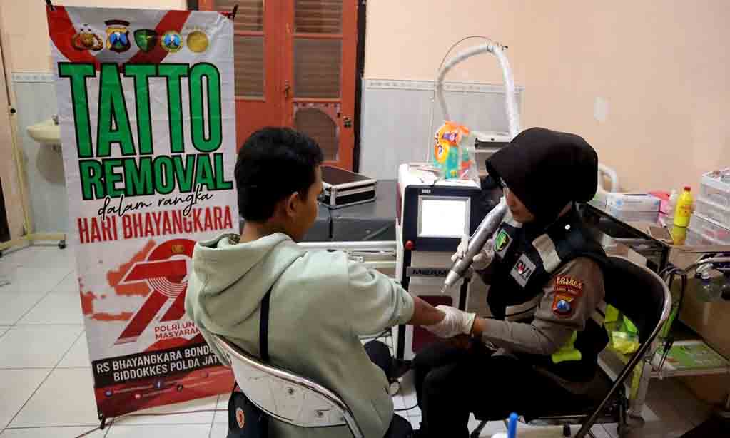 Polres situbondo beri layanan hapus tato gratis di hari bhayangkara ke 79