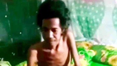 Terlupakan di Tengah Janji Kesejahteraan: Daeng Nyengka, Potret Warga Sakit dan Tak Terdata di Moncongkomba