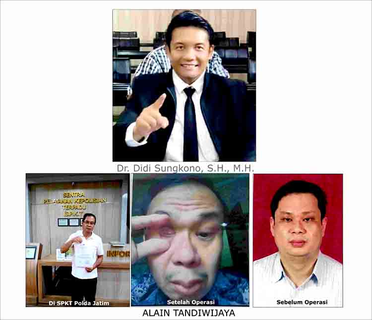 Operasi Mata Dokter RSMM Jatim ke Meja Hukum