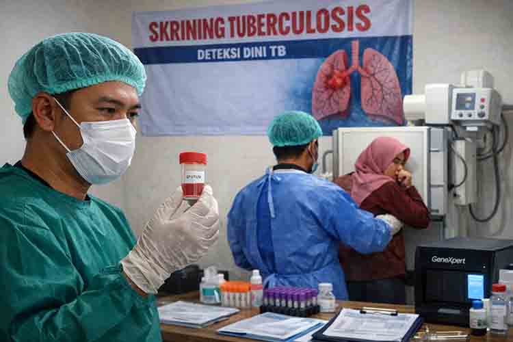 Skrining TB di Lamongan 556 Kasus Positif, 6 Meninggal